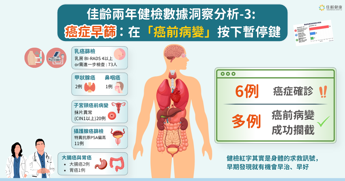 【癌症早篩】佳齡分析兩年健檢數據：6例確診與多位癌前病變給我們的健康啟示